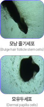 모낭 줄기세포 이미지