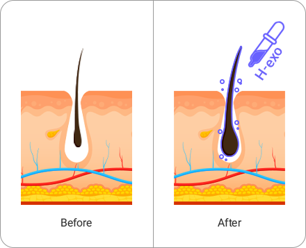 세포줄전 후 사진 