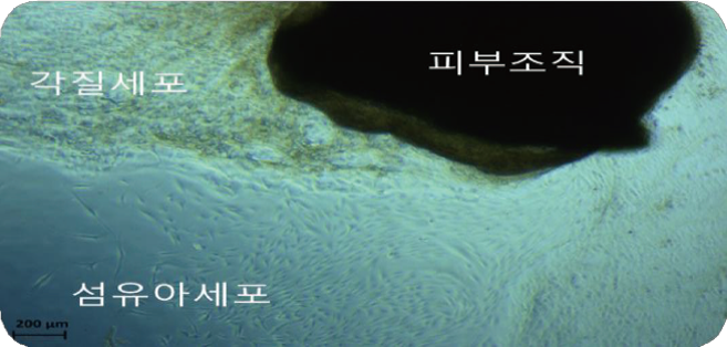 피부조직에서 세포 분리 이미지