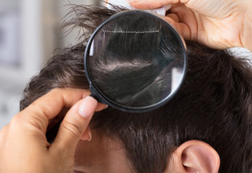 탈모 완화 이미지